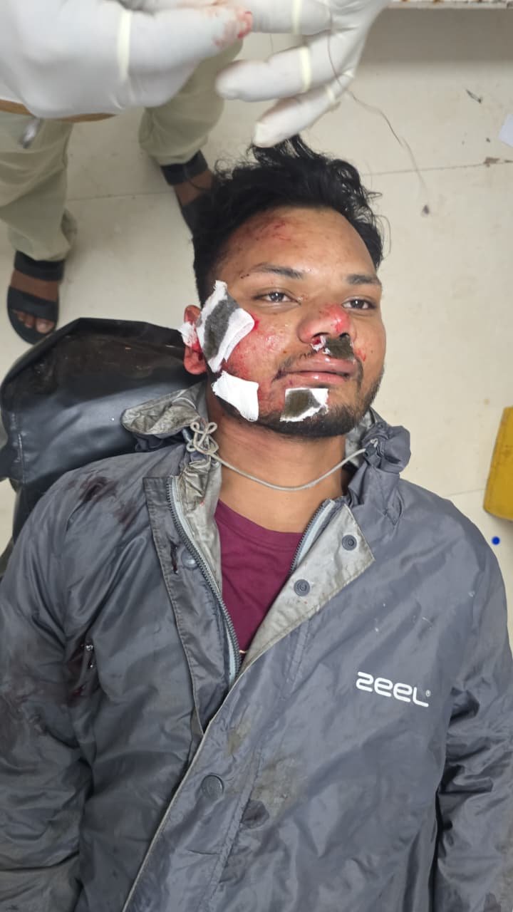 पचमढ़ी रोड पर बाइक फिसलने से युवक घायल, 112 डायल ने पहुंचाया अस्पताल